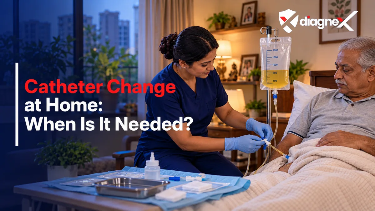 Featured illustration for Catheter Change at Home: When Is It Needed? on the Diagnex healthcare blog