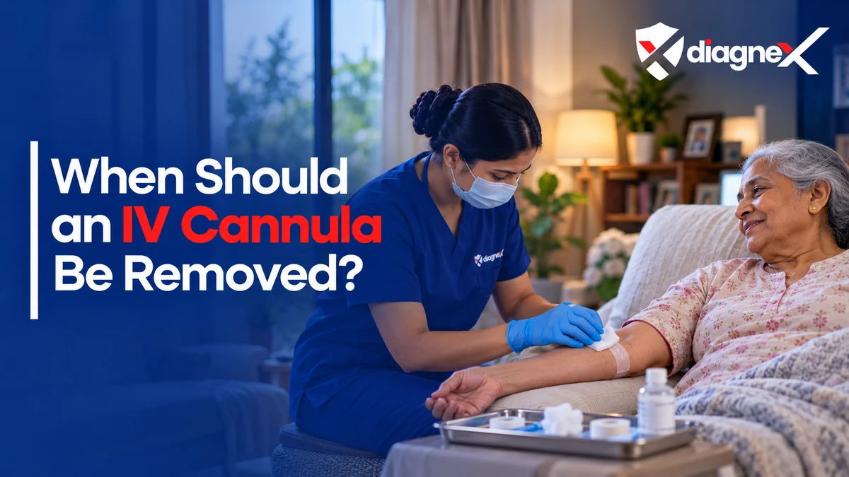 When Should an IV Cannula Be Removed? - Diagnex